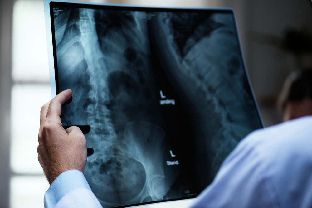 Neonatal Intestinal Obstruction