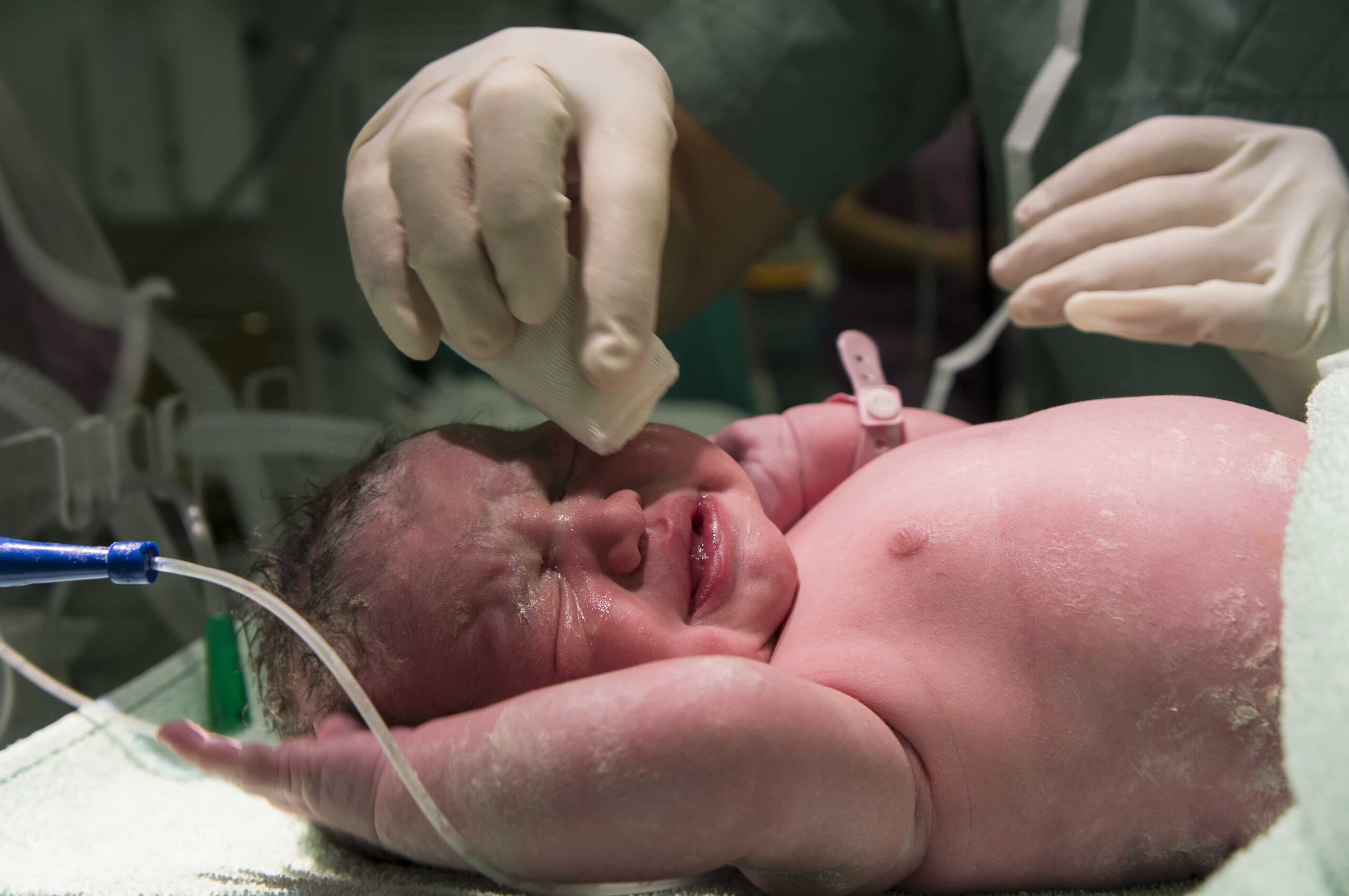 Pediatric Surgical Conditions